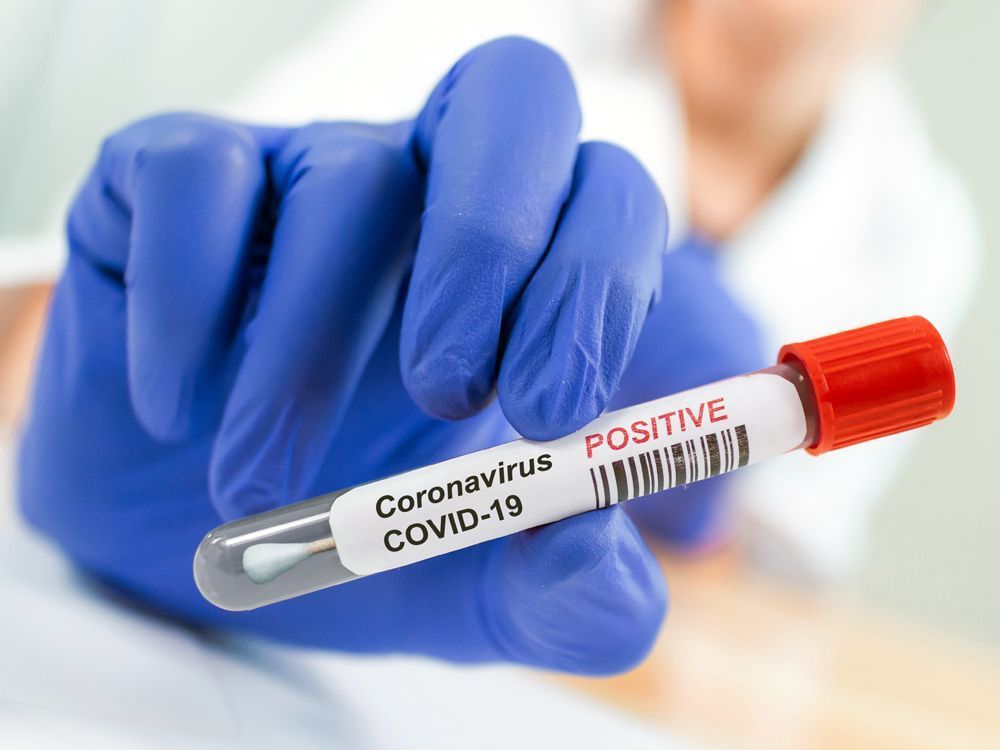 Positive Coronavirus COVID-19 Test